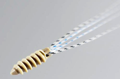 YY/T1867-2023帶線錨釘力學(xué)性能測(cè)試方法及儀器